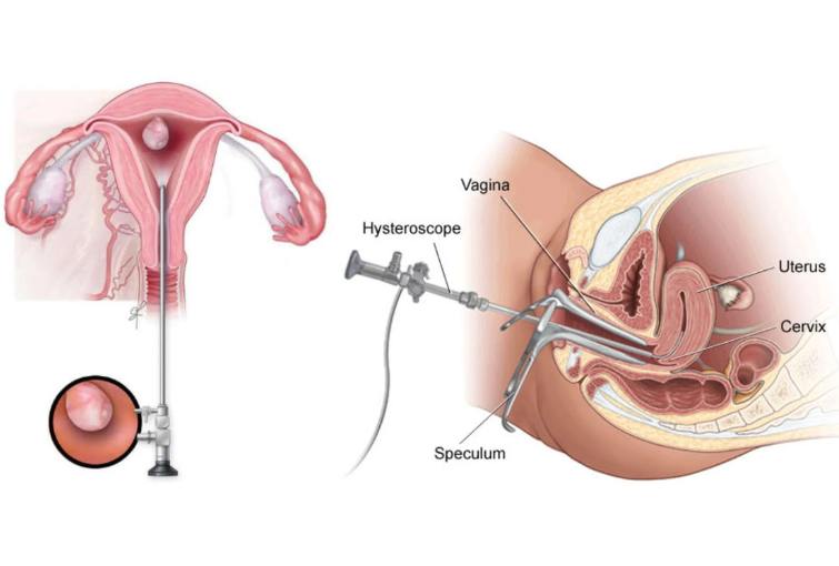 Minimally Invasive & Surgical Procedures