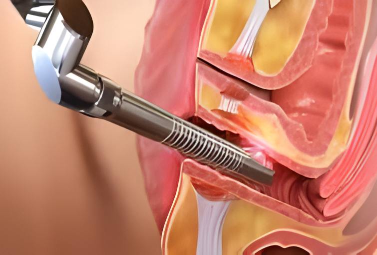 Vaginal Rejuvenation & Wellness